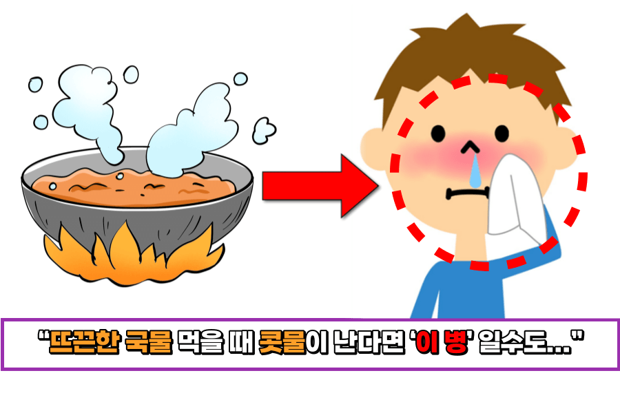 뜨끈한-국물-콧물