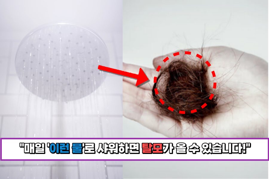 매일-이런-물로-샤워하면-탈모가-올-수-있습니다