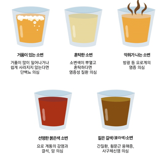 암 의심 증상1 : 혈뇨, 객혈
